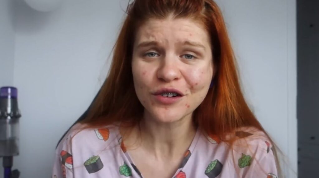 Agnieszka Niedziałek Wiek